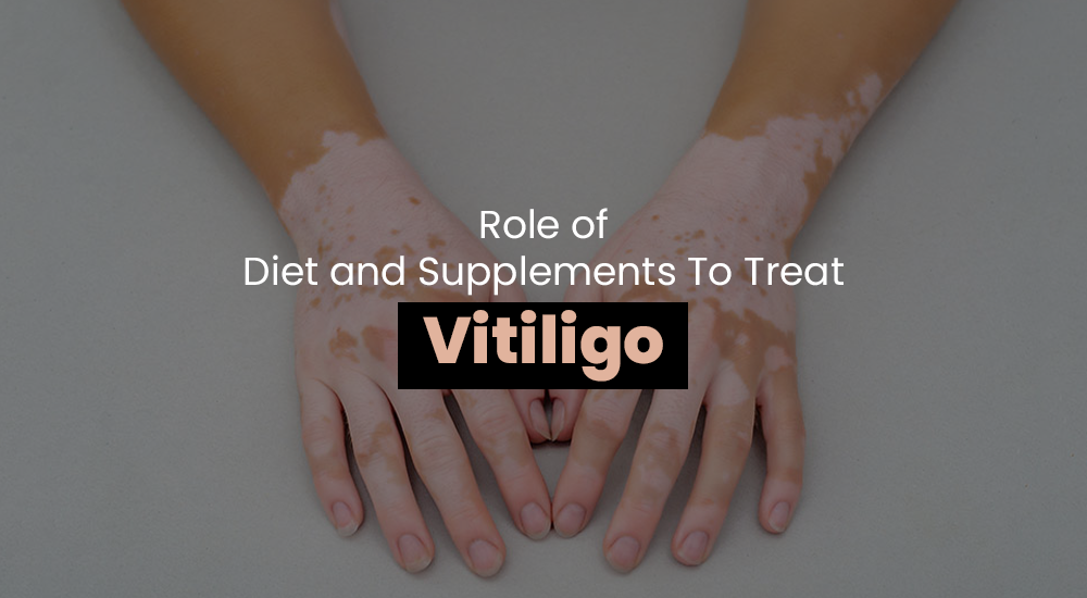 Role of Diet and Supplements To Treat Vitiligo