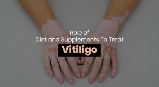 Role of Diet and Supplements To Treat Vitiligo